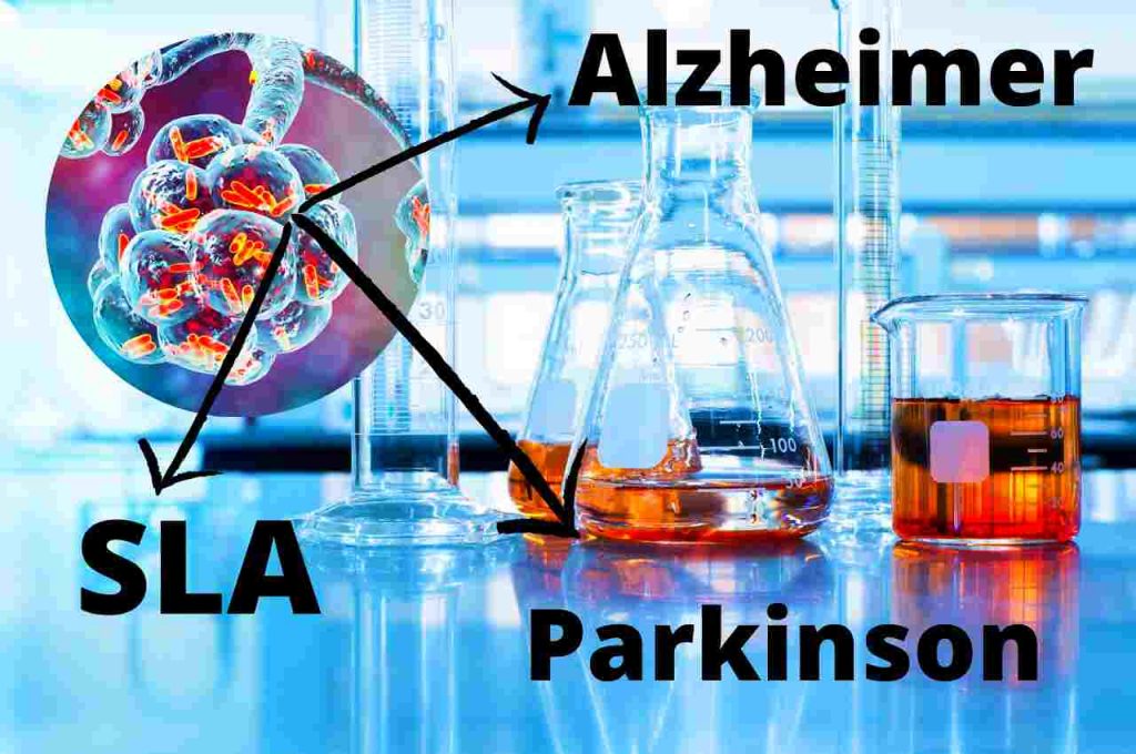 Parkinson Alzheimer