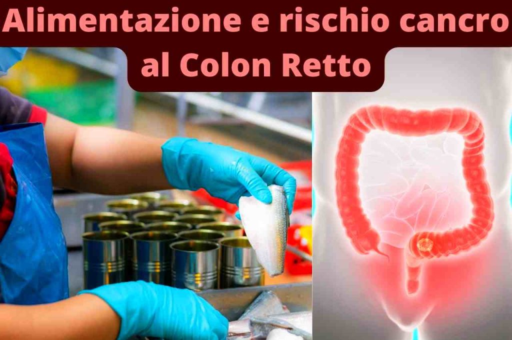 Cancro al Colon Retto