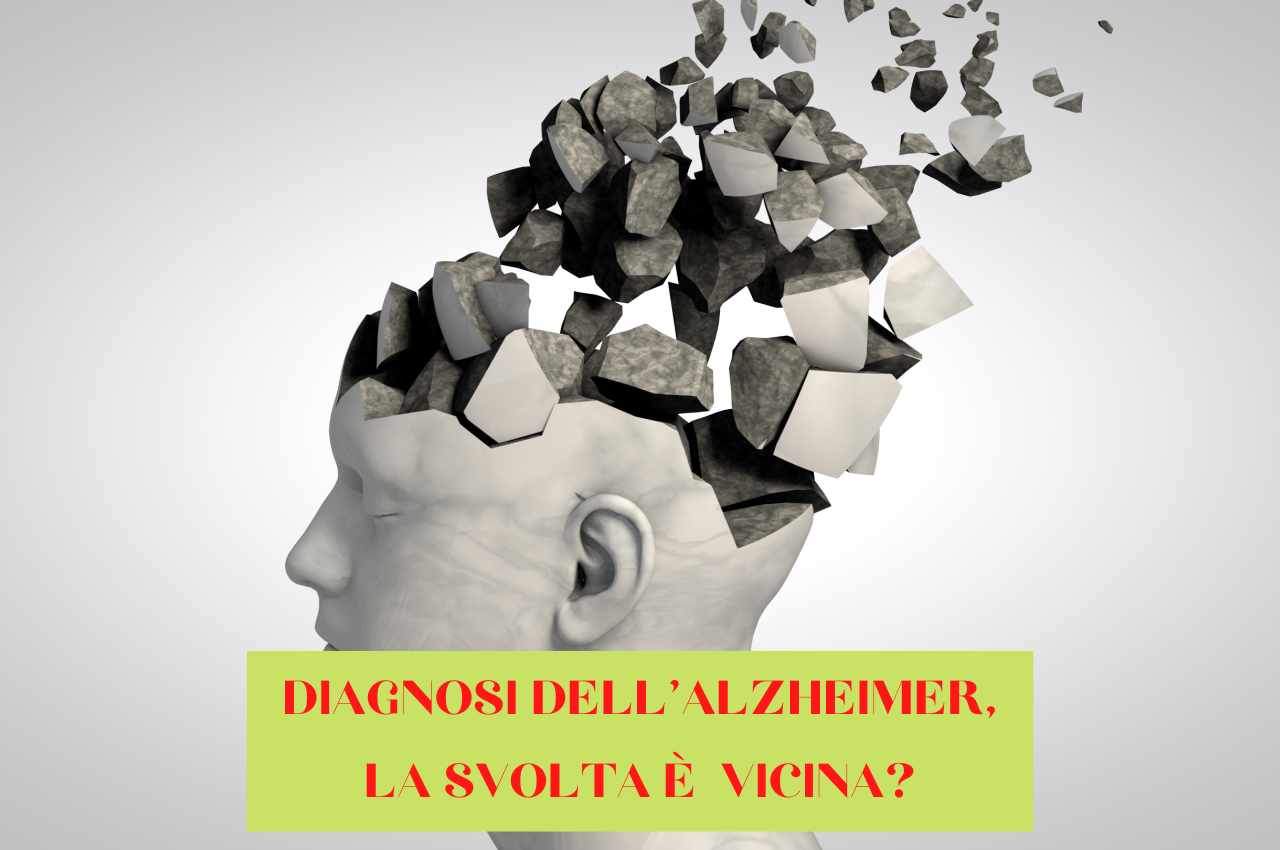 diagnosticare Alzheimer