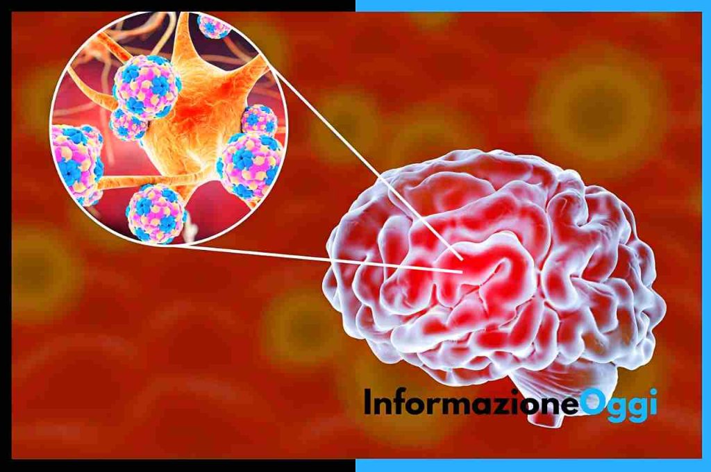 Meningite Fulminante