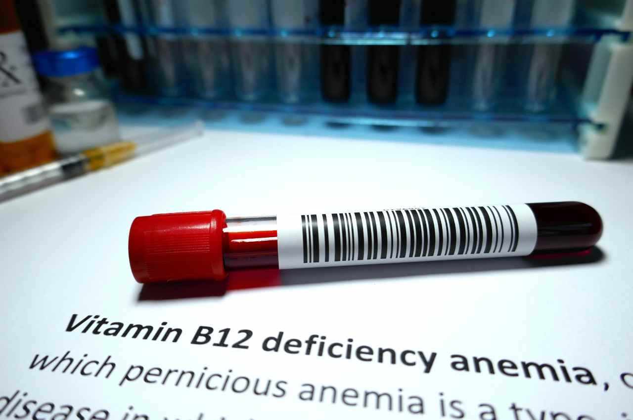 Carenza da Vitamina B12 sintomi