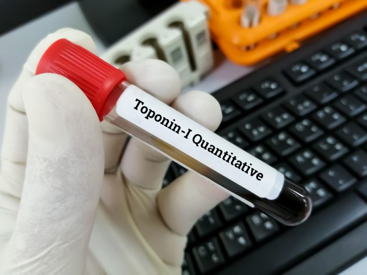 Provetta con su scritto Toponin 1 Quantitaive