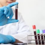 Esame clinico e medico con provette