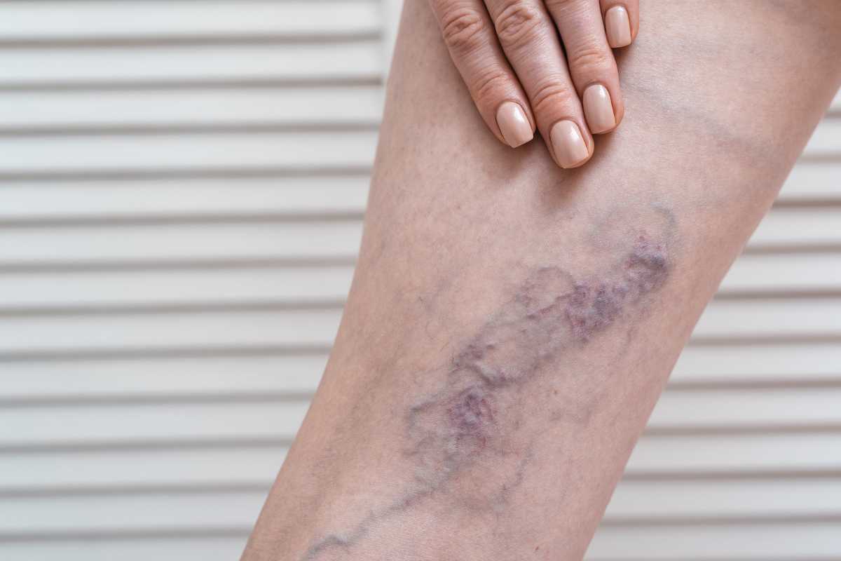 gambe trompi